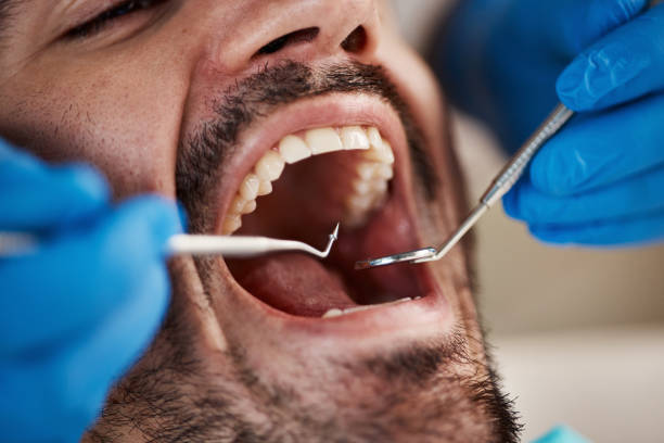 Best Oral Cancer Screening  in Monticello, IL
