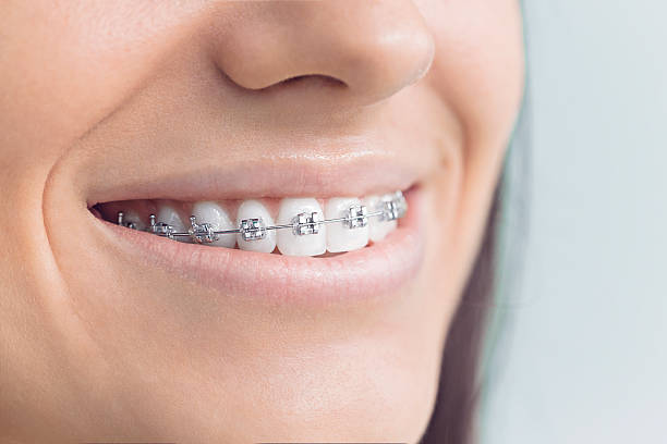 Best Root Canal Treatment  in Monticello, IL
